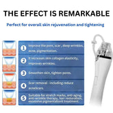 Machine de microneedling RF Pro 3 en 1